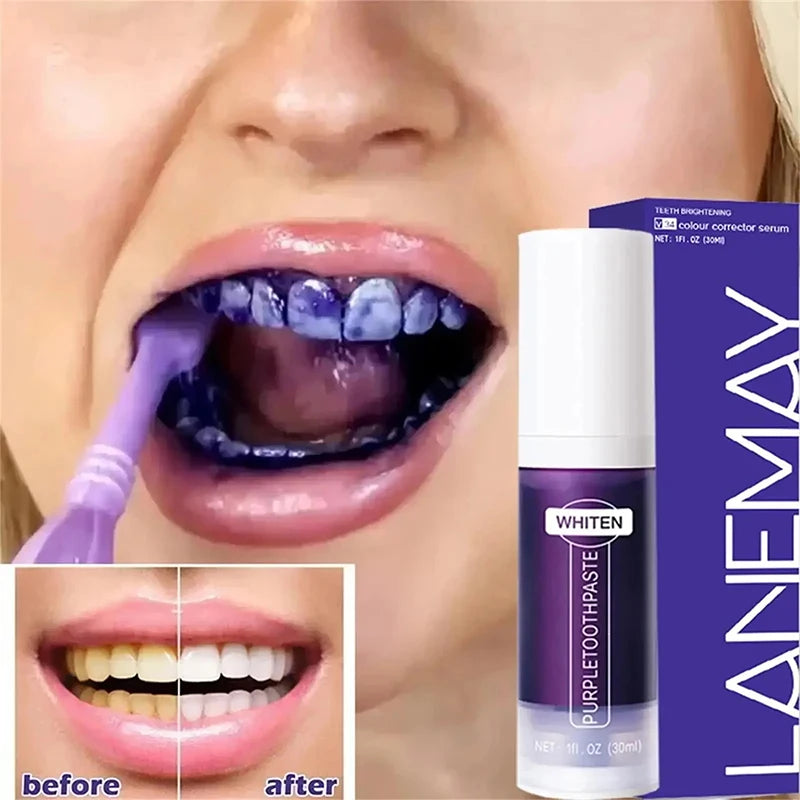New 5D Teeth Whitening Toothpaste – V34 Purple Toothpaste Stick for Teeth Cleaning, Fresh Breath & Whitening Care