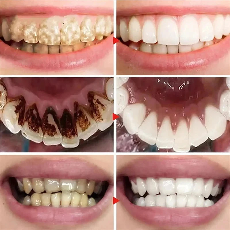 New 5D Teeth Whitening Toothpaste – V34 Purple Toothpaste Stick for Teeth Cleaning, Fresh Breath & Whitening Care