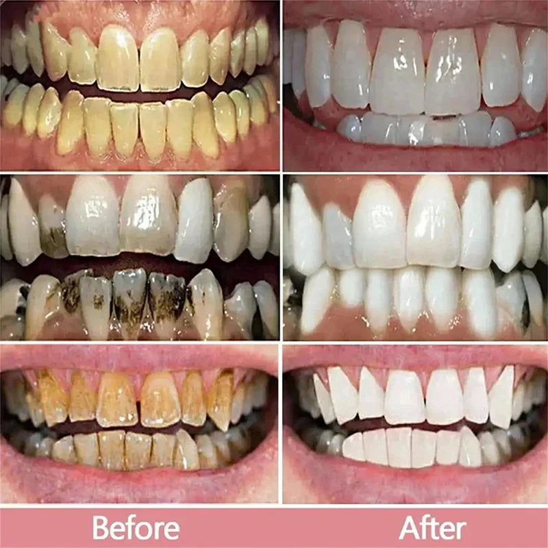 New 5D Teeth Whitening Toothpaste – V34 Purple Toothpaste Stick for Teeth Cleaning, Fresh Breath & Whitening Care