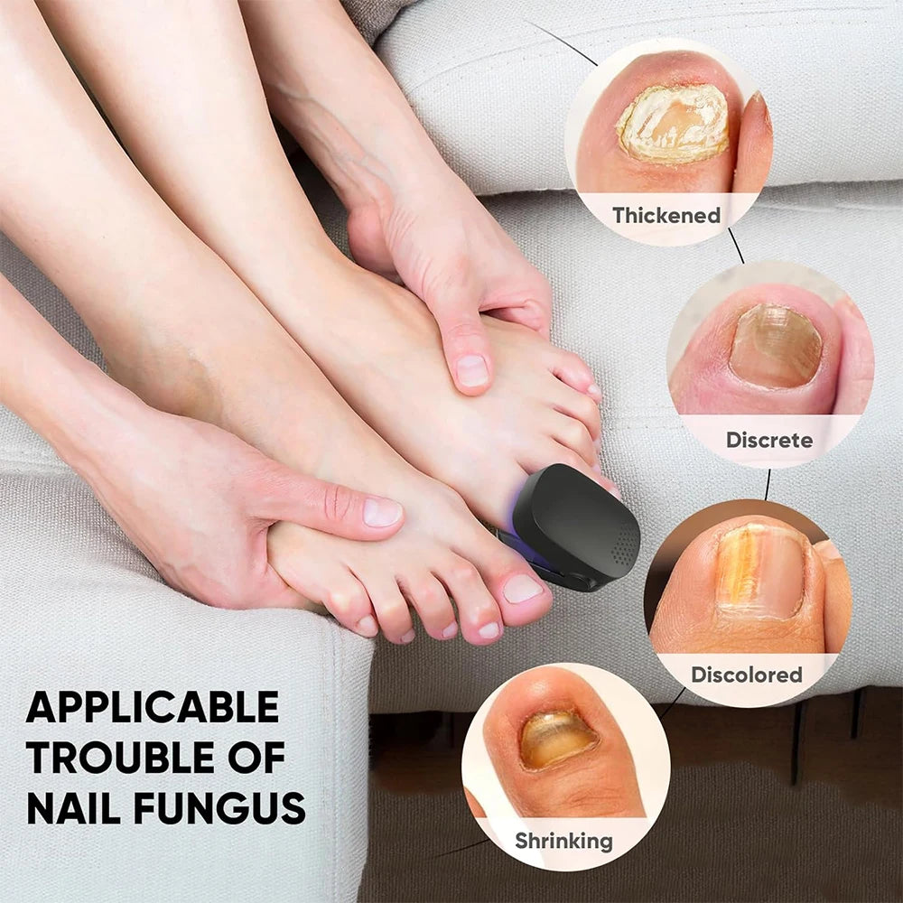 Nail Care Device Nails Fungal Treatment Repairing Thickened Gray Nails Relieve Ingrown Nail Cleaning Tools Foot Health Care