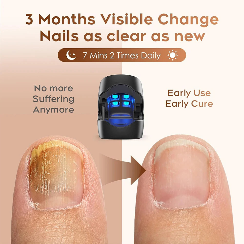 Nail Care Device Nails Fungal Treatment Repairing Thickened Gray Nails Relieve Ingrown Nail Cleaning Tools Foot Health Care