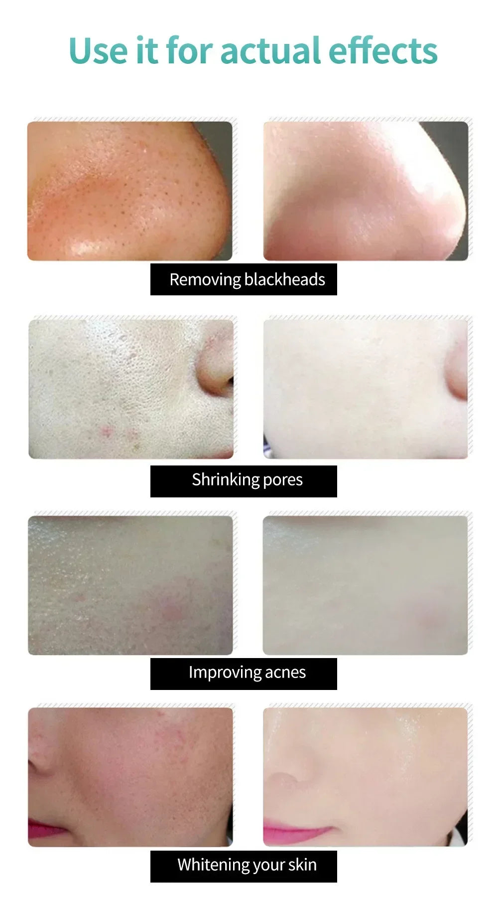 LANBENA Remove Blackhead Mask Shrinking Pore Deep Cleaning Mask Improve Rough Skin Acne Treatment Skin Brighteing Care Beauty