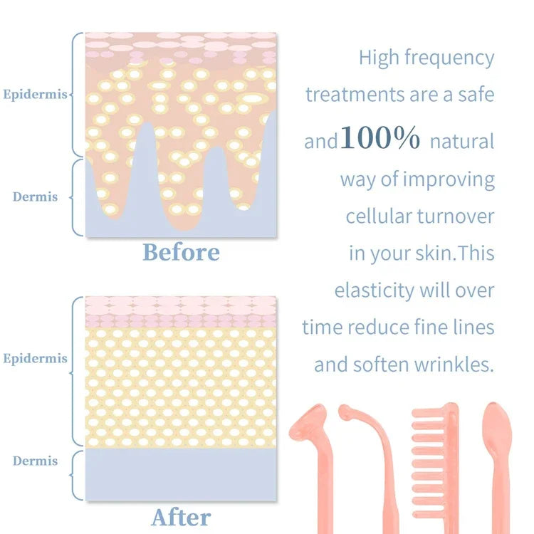 4-in-1 Handheld Electric High Frequency Beauty Device – Portable Machine for Skin Care & Acne Treatment with Neon Facial Therapy Wand