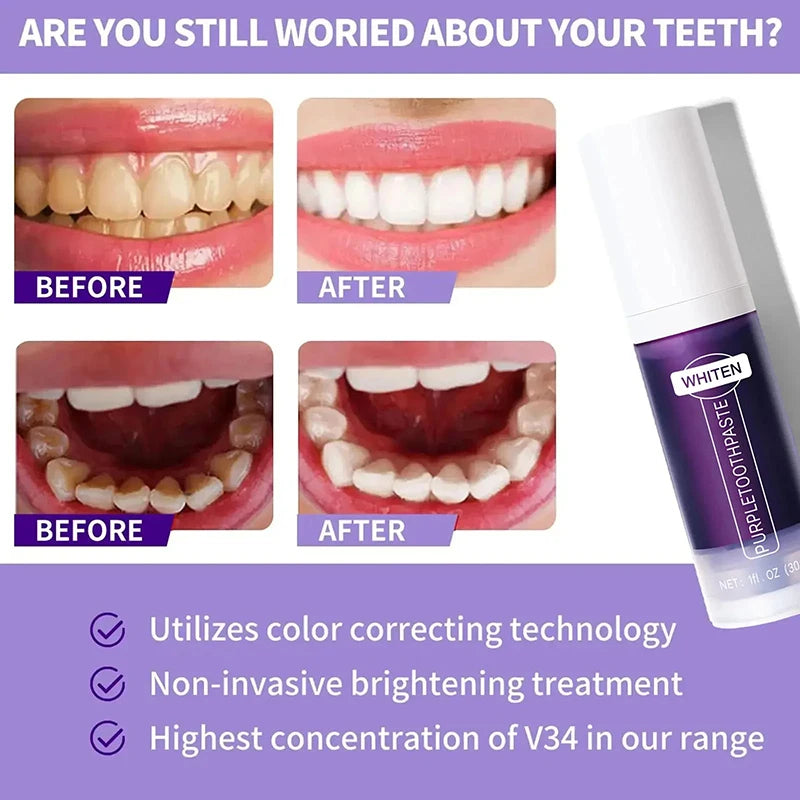 New 5D Teeth Whitening Toothpaste – V34 Purple Toothpaste Stick for Teeth Cleaning, Fresh Breath & Whitening Care