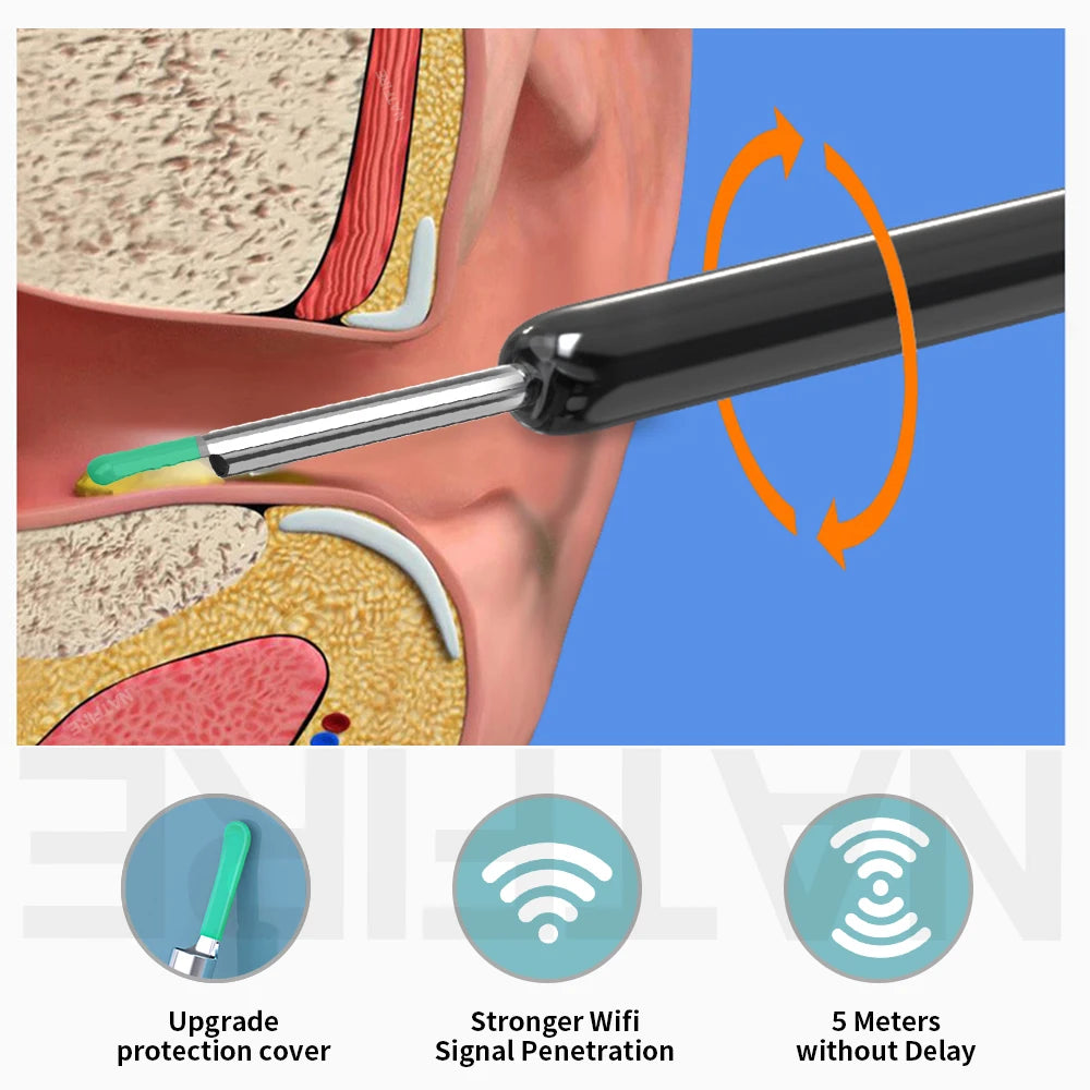 Smart Visual Ear Cleaner with HD Camera | Wireless Otoscope Ear Cleaning Stick USB-C Charging Earpick Tool Set