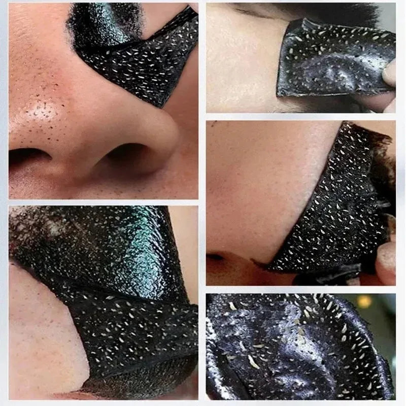 LANBENA Remove Blackhead Mask Shrinking Pore Deep Cleaning Mask Improve Rough Skin Acne Treatment Skin Brighteing Care Beauty