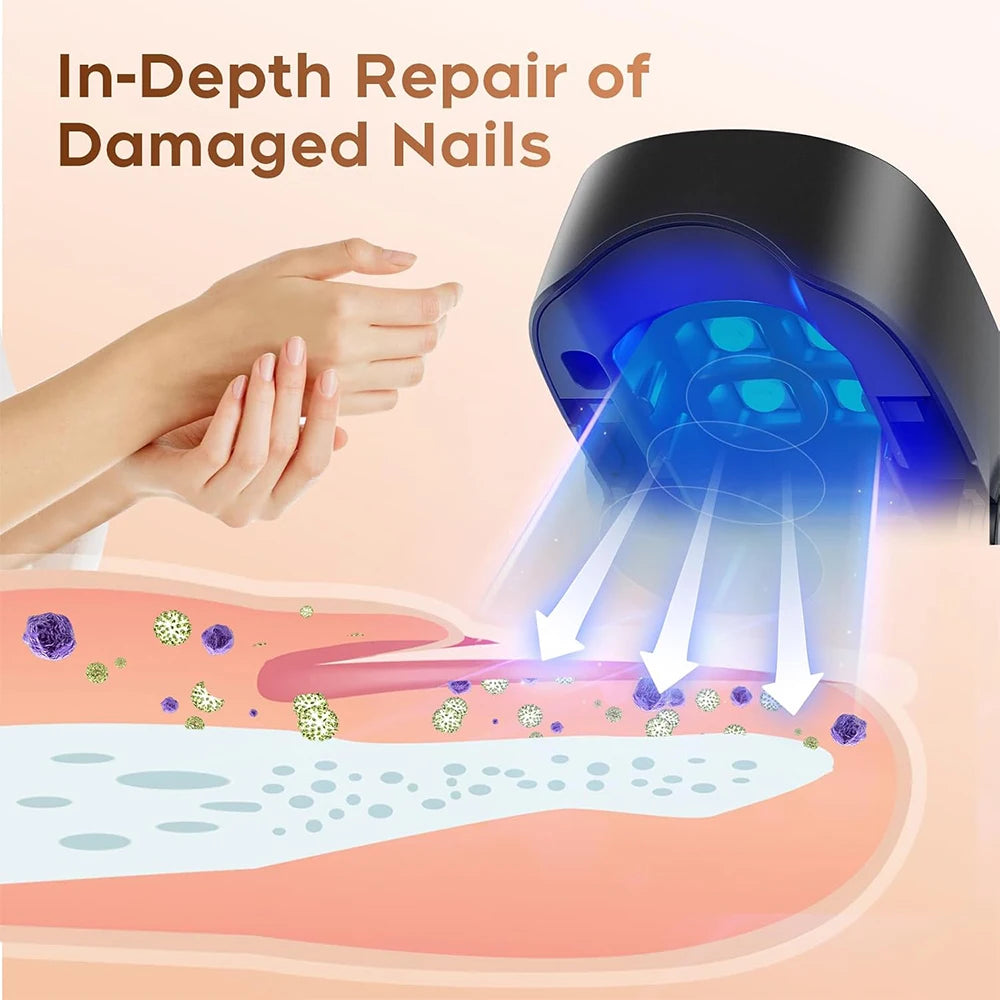 Nail Care Device Nails Fungal Treatment Repairing Thickened Gray Nails Relieve Ingrown Nail Cleaning Tools Foot Health Care