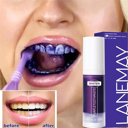 New 5D Teeth Whitening Toothpaste – V34 Purple Toothpaste Stick for Teeth Cleaning, Fresh Breath & Whitening Care
